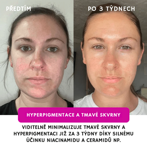 GlowLift Collagen Overnight Peel-Off Mask