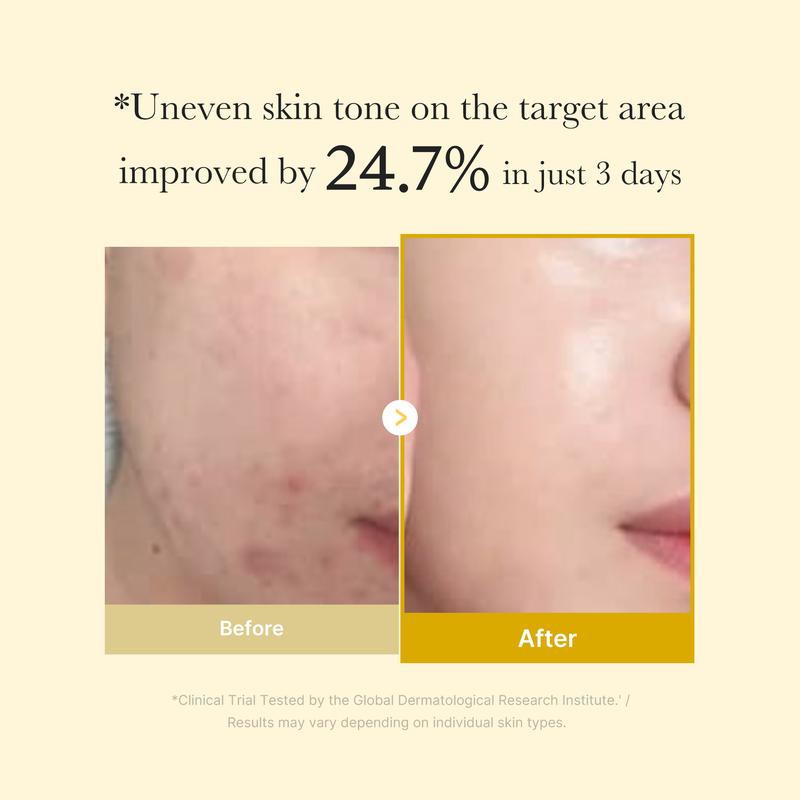 Masque enveloppant à l’acide kojique et au curcuma